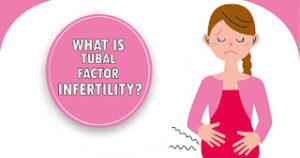 Tubical Factor Infertility