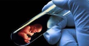 Test Tube Baby (IVF)