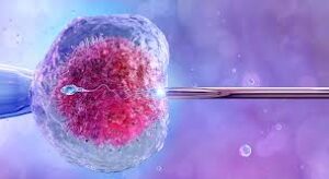 IVF (In Vitro Fertilization)