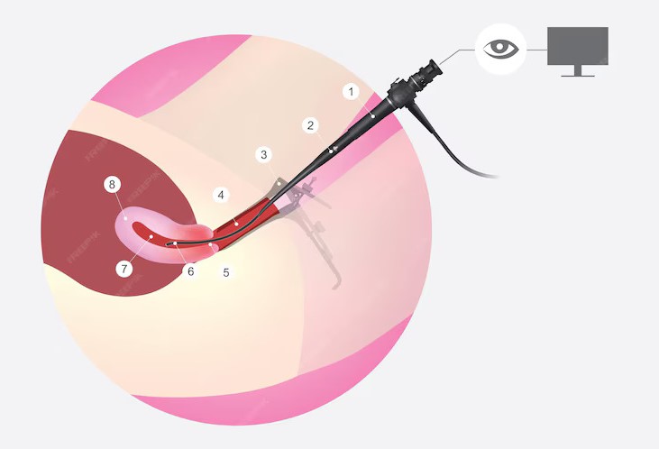 Hysteroscopy Cost in Mumbai