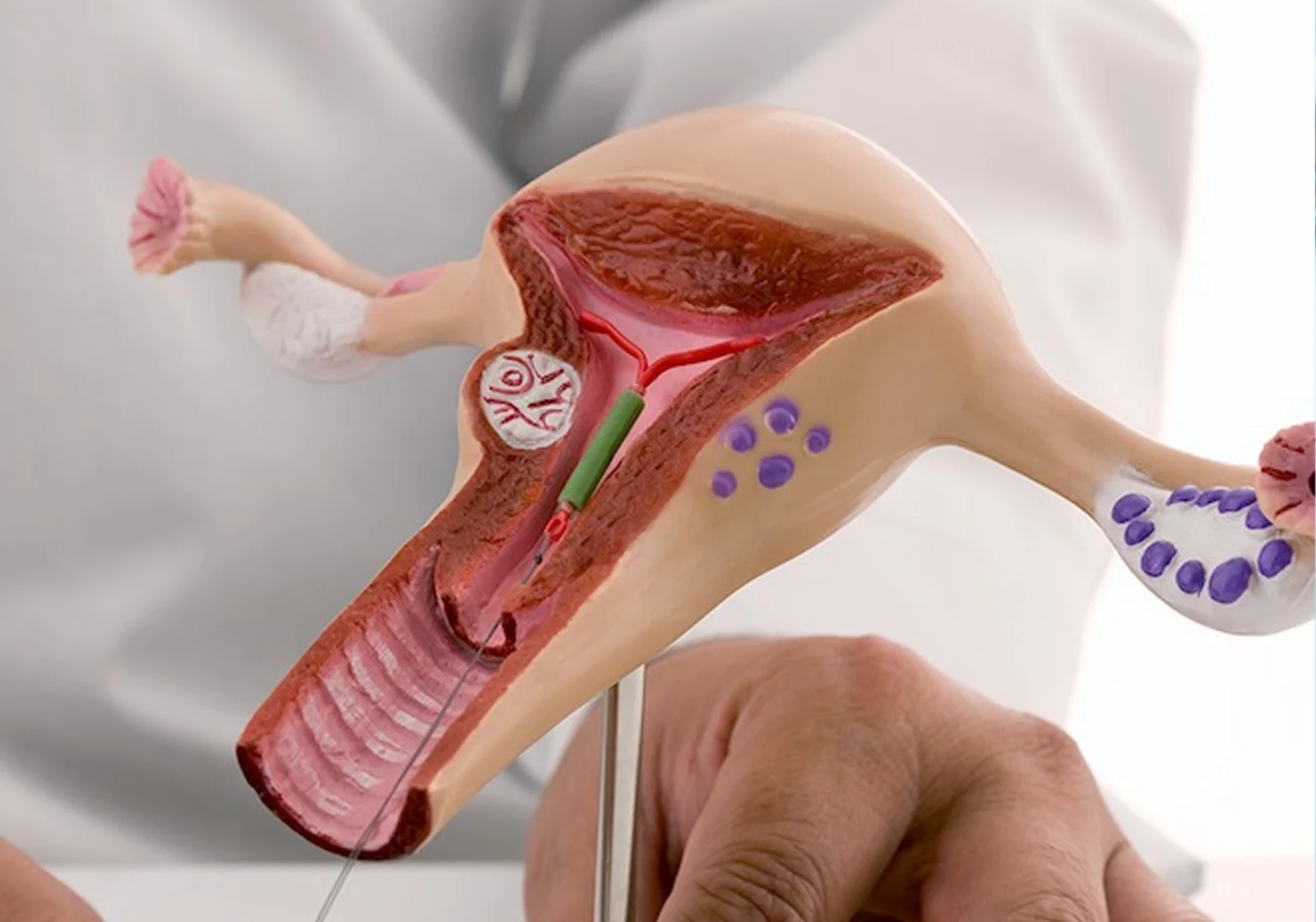 IUI Success Tips from Doctors: What to Do Before, During & After